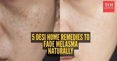 मेलास्मा (झाई) पासून सुटका करण्यासाठी 5 घरगुती उपाय