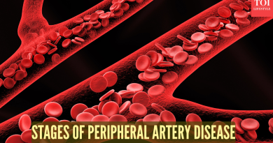 रक्ताभिसरणाच्या सौम्य समस्यांपासून गंभीर अवयव इस्केमियापर्यंत