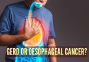 अन्ननलिका कर्करोग वि GERD: लक्षणे, कारणे आणि मुख्य फरक |