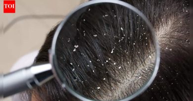 जस्त डोक्यातील कोंडा नियंत्रित करण्यास आणि निरोगी, फ्लेक-मुक्त टाळू राखण्यास कशी मदत करते |