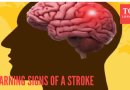 स्ट्रोकची 5 चेतावणी चिन्हे जी एक महिन्यापूर्वी येऊ शकतात