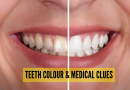पिवळा ते ठिपके: विविध प्रकारचे दातांचे रंग आरोग्याविषयी, लपलेल्या वैद्यकीय स्थितीबद्दल काय प्रकट करतात