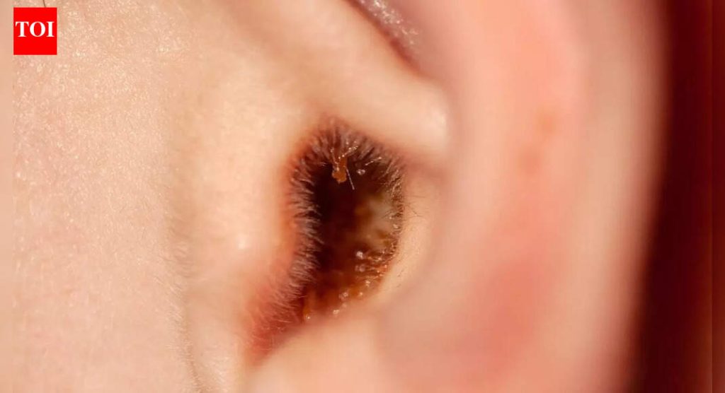 इअरवॅक्स साफ करण्यासाठी तुम्ही इअरबड का वापरू नये आणि त्याऐवजी काय करावे |