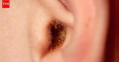 इअरवॅक्स साफ करण्यासाठी तुम्ही इअरबड का वापरू नये आणि त्याऐवजी काय करावे |