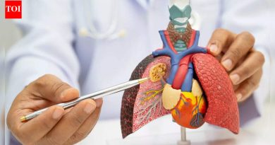 जगातील पहिल्या फुफ्फुसाचा कर्करोग प्रतिबंध लस चाचणी कर्करोग सुरू होण्याआधी थांबविण्यासाठी £2.06 दशलक्ष निधीसह |