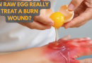 अंड्याचा पांढरा खरच जळलेल्या जखमा भरतो का? प्राणघातक संसर्गाच्या धोक्याचा डॉक्टरांचा इशारा |