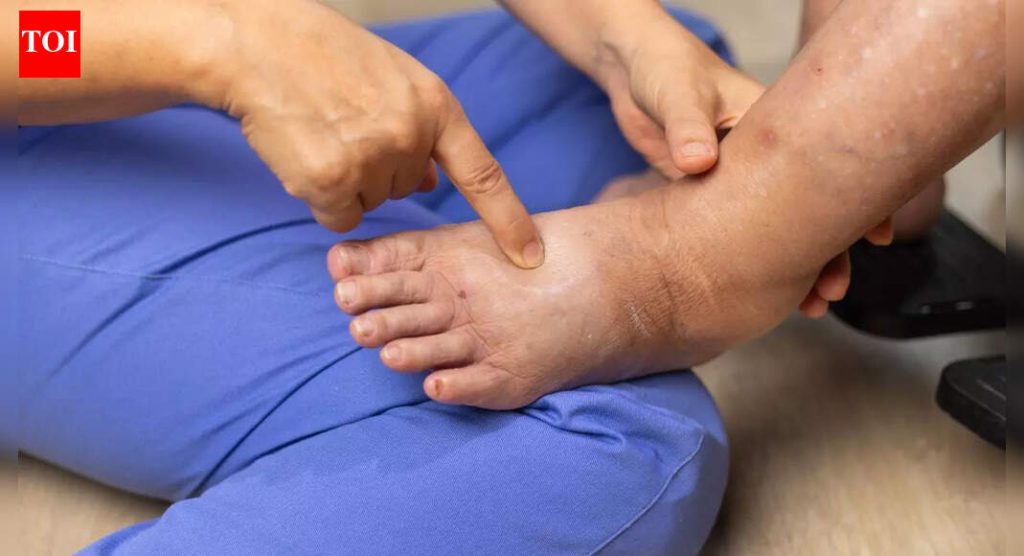 पाय आणि घोट्या कशामुळे सुजतात: हृदय, यकृत, किडनी रोग आणि DVT पासून पेडल एडेमामागील लपलेली कारणे |