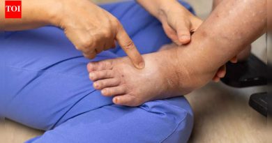 पाय आणि घोट्या कशामुळे सुजतात: हृदय, यकृत, किडनी रोग आणि DVT पासून पेडल एडेमामागील लपलेली कारणे |