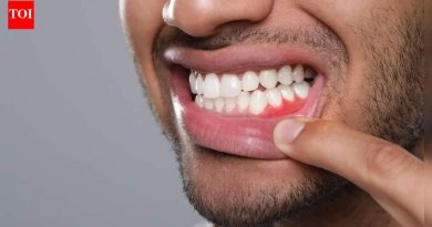 हिरड्यांचे आजार दातांपेक्षा जास्त प्रभावित करू शकतात: खराब तोंडी आरोग्य स्ट्रोकचा धोका कसा वाढवते; तोंडी आणि मेंदूच्या आरोग्याचे रक्षण करण्यासाठी प्रमुख टिप्स |