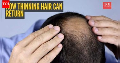 ‘तुमचे केस परत येऊ शकतात’: डॉक्टरांनी पातळ होणारे केस पुनर्संचयित करण्यासाठी विज्ञान-समर्थित योजना शेअर केली |