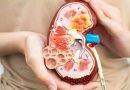किडनीचे नुकसान नैसर्गिकरित्या उलट करा: जळजळ कमी करण्यासाठी आणि चयापचय वाढवण्यासाठी अन्न आणि सवयी |