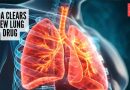 FDA ने ‘Jascayd फॉर प्रोग्रेसिव्ह पल्मोनरी फायब्रोसिस: याचा अर्थ रूग्णांसाठी काय अर्थ आहे FDA ने ‘Jascayd फॉर प्रोग्रेसिव्ह पल्मोनरी फायब्रोसिस: याचा अर्थ रूग्णांसाठी काय अर्थ आहे