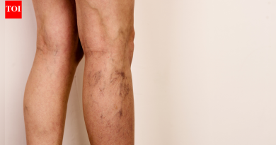 रक्ताभिसरण सुधारण्यासाठी आणि अशुद्ध रक्तवाहिन्या फुगून झालेल्या गाठींचा नसा अस्वस्थता कमी करण्यासाठी साधे दैनंदिन व्यायाम