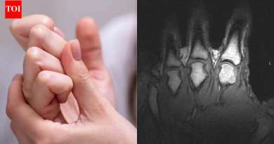 तुमचे पोर फोडल्याने ते मोठे होतात का? शास्त्रज्ञांनी अखेरीस दीर्घकालीन समज सोडवली |