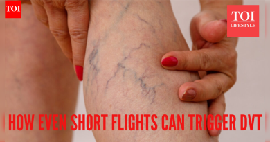 एका तासाच्या उड्डाणानंतर महिला डीप वेन थ्रोम्बोसिससह रुग्णालयात दाखल; हे का घडते हे शीर्ष डॉक्टर प्रकट करतात