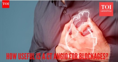 हृदयातील अडथळे शोधण्यासाठी तुम्हाला खरोखर सीटी अँजिओग्राफीची आवश्यकता आहे का? अग्रगण्य डॉक्टर काही समज खोडून काढतात